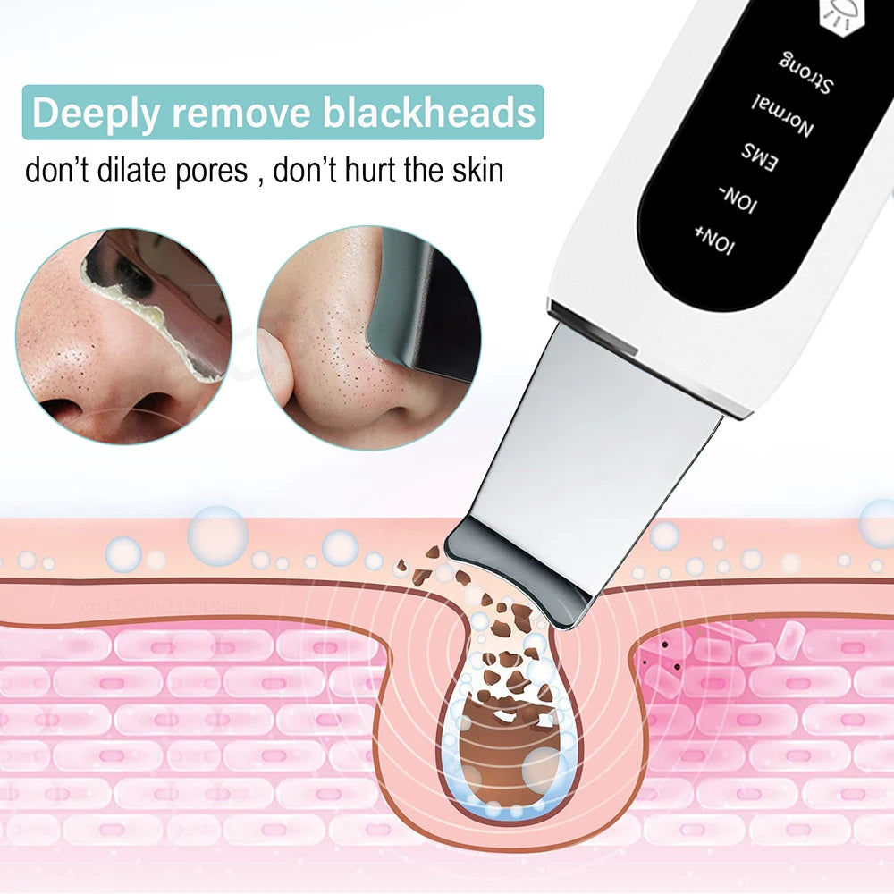 Ultrasonic Skin Scrubber Blackhead Remover