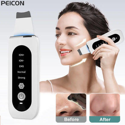 Ultrasonic Skin Scrubber Blackhead Remover